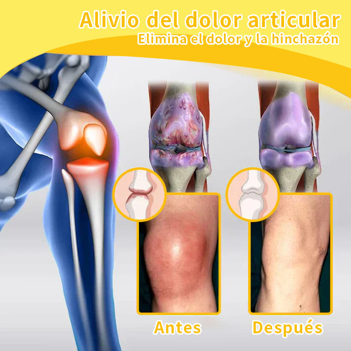 ODALIT™ Toxina Botulínica & Veneno de Abeja Alivio del Dolor Crema Cicatrizante de Huesos🔄