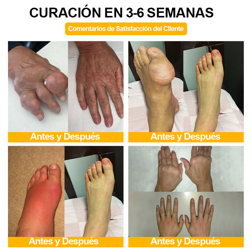 ODALIT™ Toxina Botulínica & Veneno de Abeja Alivio del Dolor Crema Cicatrizante de Huesos🔄