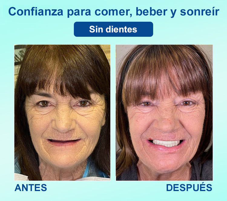 DIYSTAR™ 🍀 𝐏𝐫𝐨́𝐭𝐞𝐬𝐢𝐬 𝐃𝐞𝐧𝐭𝐚𝐥 𝐏𝐫𝐞𝐦𝐢𝐮𝐦 (🦷 ¡Descuento por tiempo limitado – Últimos 30 minutos! 🦷)