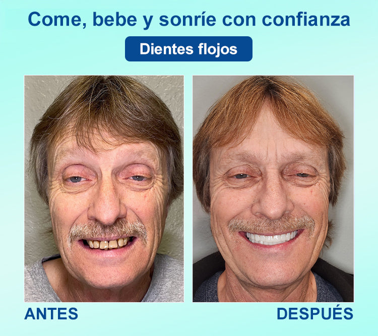 DIYSTAR™ 🍀 𝐏𝐫𝐨́𝐭𝐞𝐬𝐢𝐬 𝐃𝐞𝐧𝐭𝐚𝐥 𝐏𝐫𝐞𝐦𝐢𝐮𝐦 (🦷 ¡Descuento por tiempo limitado – Últimos 30 minutos! 🦷)