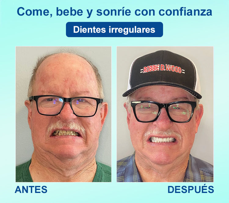 DIYSTAR™ 🍀 𝐏𝐫𝐨́𝐭𝐞𝐬𝐢𝐬 𝐃𝐞𝐧𝐭𝐚𝐥 𝐏𝐫𝐞𝐦𝐢𝐮𝐦 (🦷 ¡Descuento por tiempo limitado – Últimos 30 minutos! 🦷)