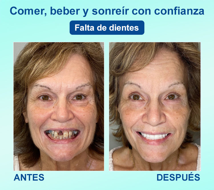 DIYSTAR™ 🍀 𝐏𝐫𝐨́𝐭𝐞𝐬𝐢𝐬 𝐃𝐞𝐧𝐭𝐚𝐥 𝐏𝐫𝐞𝐦𝐢𝐮𝐦 (🦷 ¡Descuento por tiempo limitado – Últimos 30 minutos! 🦷)