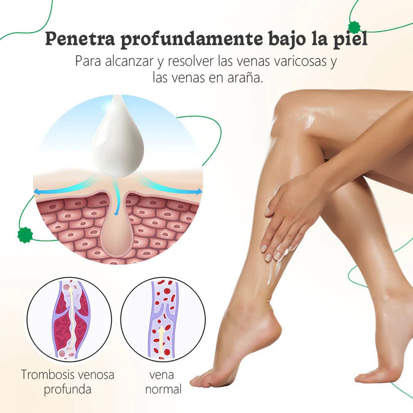 ODALIT™ Crema de Terapia para Venas