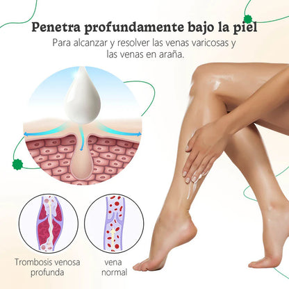 ODALIT™ Crema de Terapia para Venas