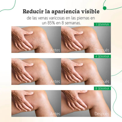ODALIT™ Crema de Terapia para Venas