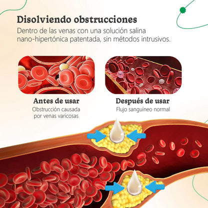 ODALIT™ Crema de Terapia para Venas