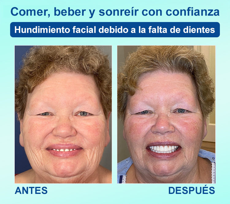 DIYSTAR™ 🍀 𝐏𝐫𝐨́𝐭𝐞𝐬𝐢𝐬 𝐃𝐞𝐧𝐭𝐚𝐥 𝐏𝐫𝐞𝐦𝐢𝐮𝐦 (🦷 ¡Descuento por tiempo limitado – Últimos 30 minutos! 🦷)