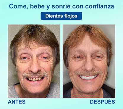 DIYSTAR™ 🍀 𝐏𝐫𝐨́𝐭𝐞𝐬𝐢𝐬 𝐃𝐞𝐧𝐭𝐚𝐥 𝐏𝐫𝐞𝐦𝐢𝐮𝐦 (🦷 ¡Descuento por tiempo limitado – Últimos 30 minutos! 🦷)